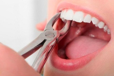 Best Dental Clinic In Aundh