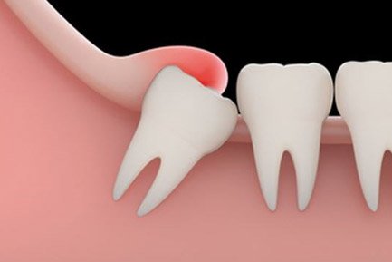 Best Dental Clinic In Aundh